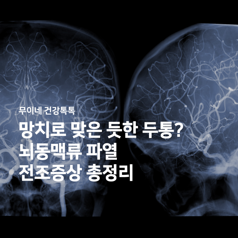 "뒷목이 뻐근하고 망치로 맞은 듯한 두통?" 뇌동맥류 파열 전조증상 총정리