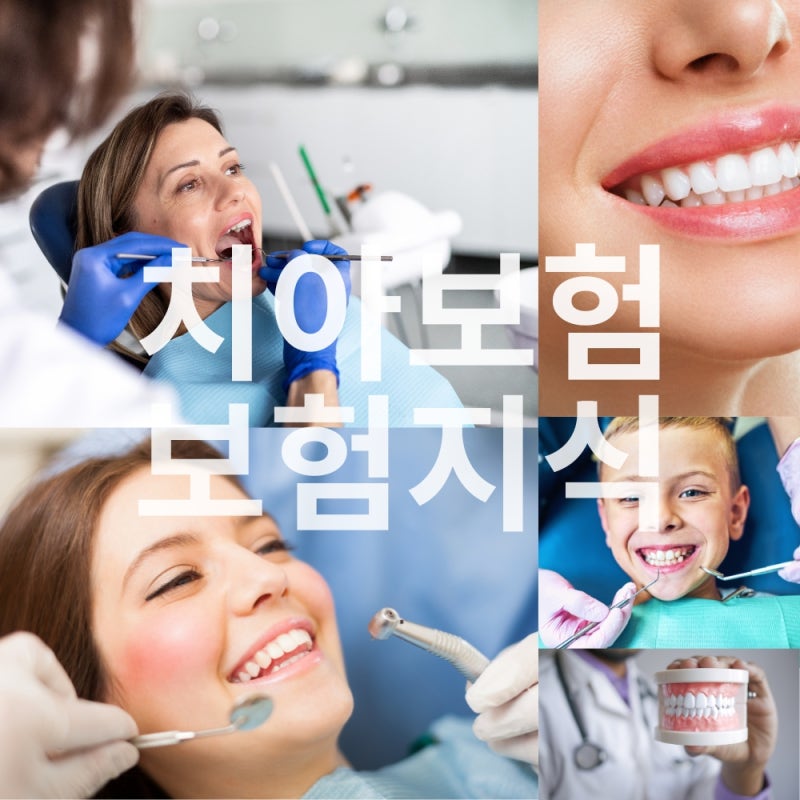 [치아보험]보험정보,치아보험지식,치아보험 꿀팁 공유