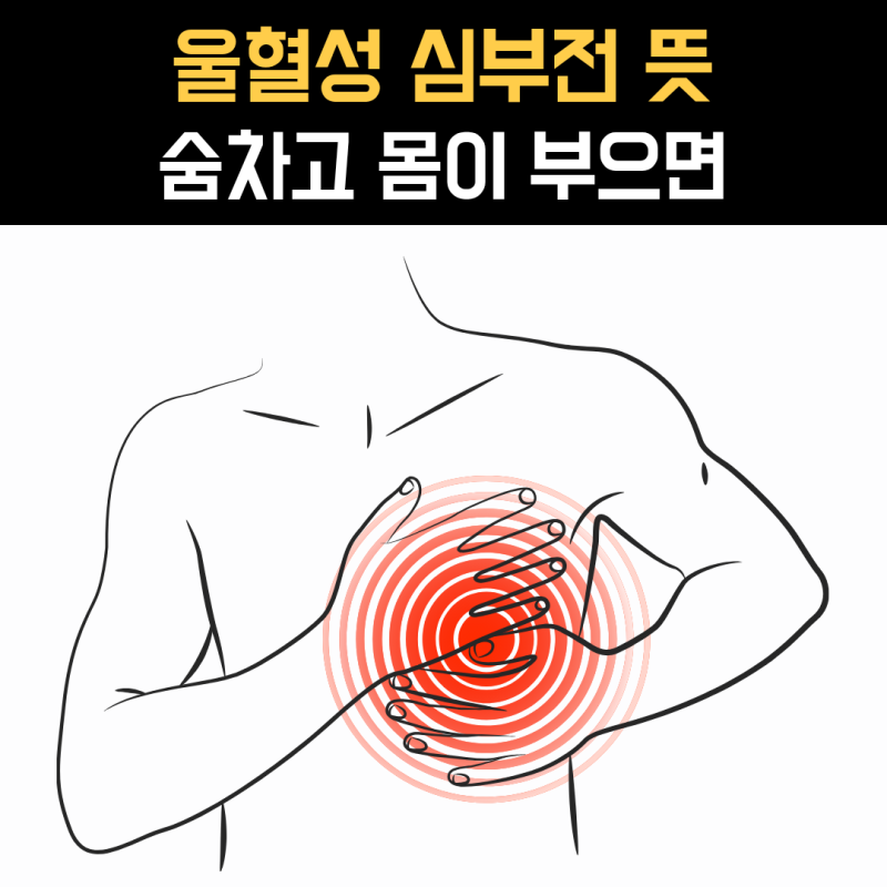 울혈성 심부전 뜻, 숨차고 다리가 붓는 이유는
