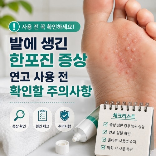 발에 생긴 한포진 증상 연고 사용 전 확인할 주의사항