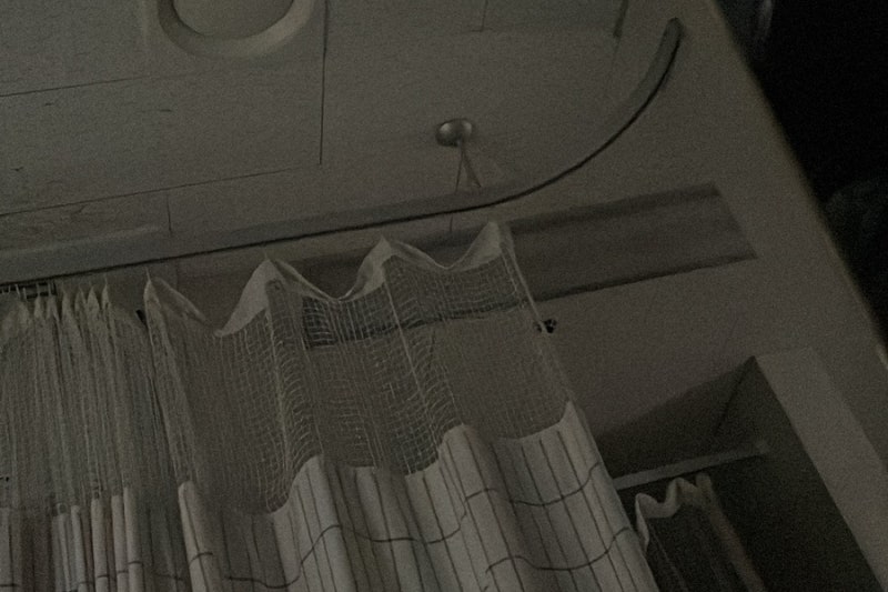 수술을 했고, 어른이 되었다 | 난소 자궁내막종 경상대학교병원 로봇 수술 후기