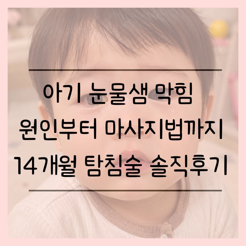 아기 눈물샘 막힘 증상 총정리! 마사지부터 14개월 탐침술 후기까지