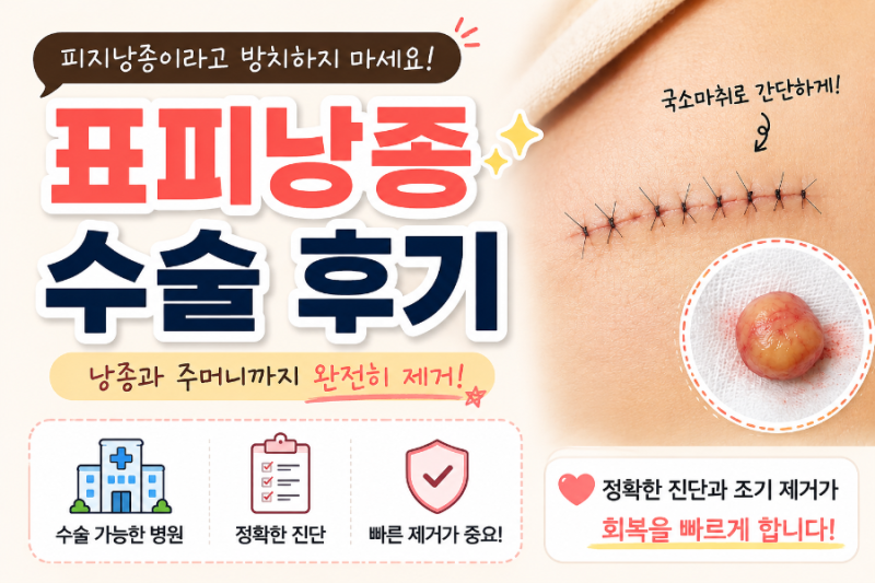 [엄마일상] 표피낭종 수술후기