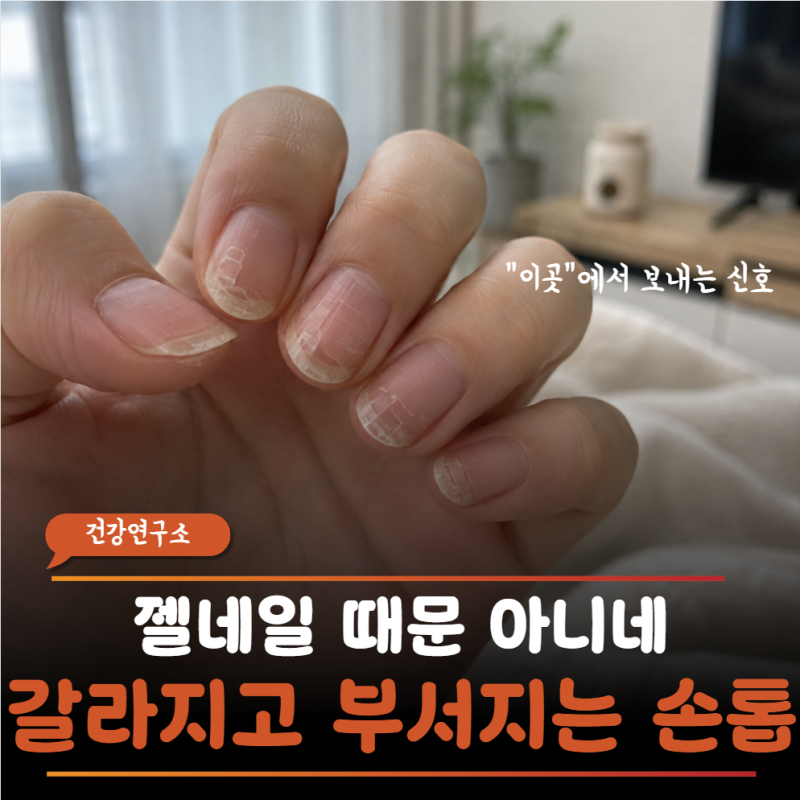 "손톱이 자꾸 부서지고 찢어진다면?" 몸속 영양 부족이 아니라 갑상선 보내는 SOS