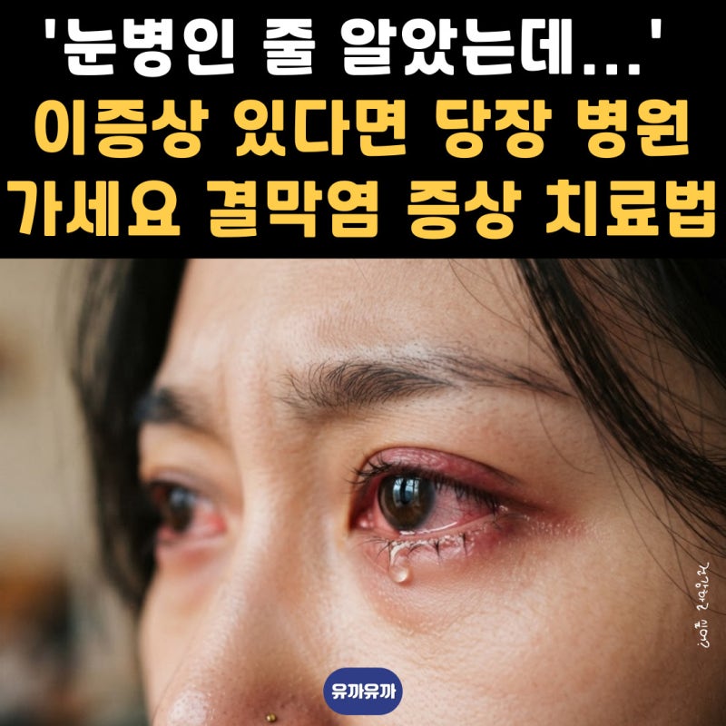 '눈병인 줄 알았는데...' 이증상 있다면 당장 병원가세요 결막염 증상 치료법