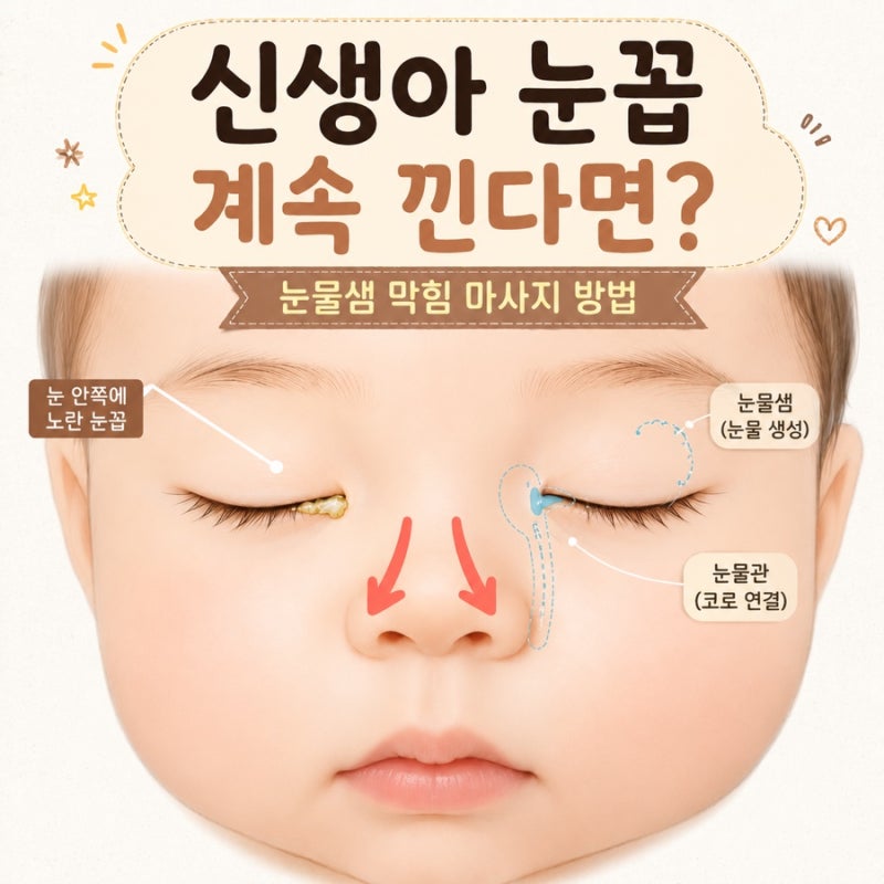신생아 눈꼽 계속 낀다면? 아기 눈물샘 막힘 마사지 방법