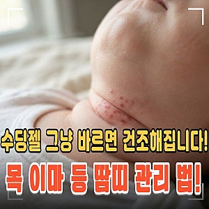 아기 땀띠 증상과 수딩젤 바르는법! 목 이마 등 땀띠 관리 수칙