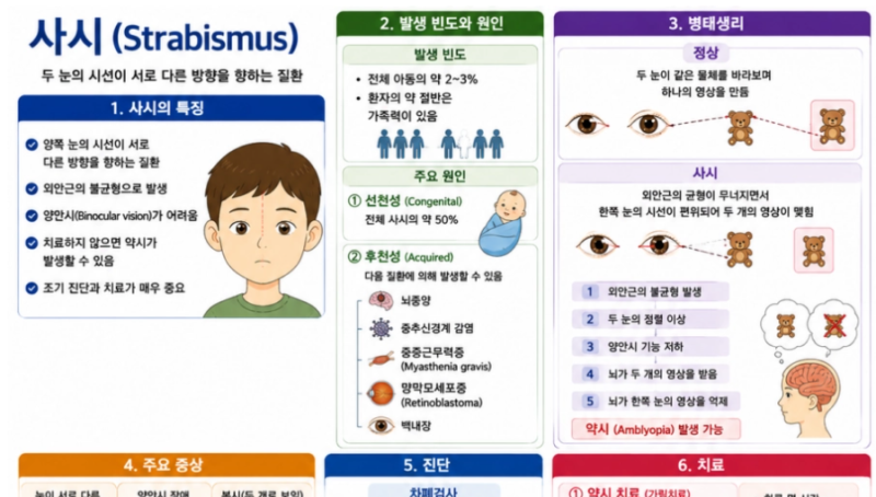 [성인간호학] 49. 사시(Strabismus)
