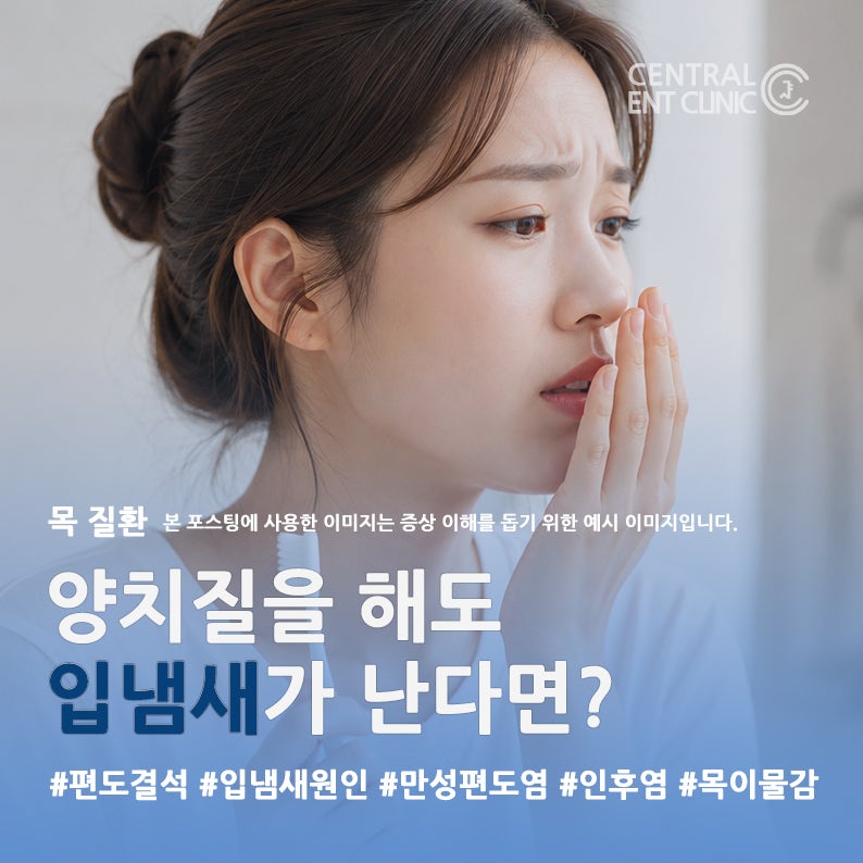 편도결석, 입냄새의 원인일 수도 있습니다