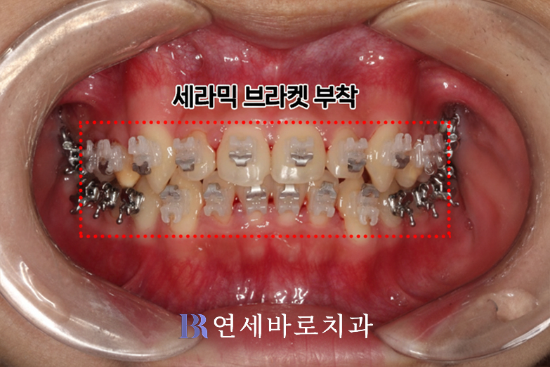 대전 둔산동 치과 치료비용이 왜 다른가요?