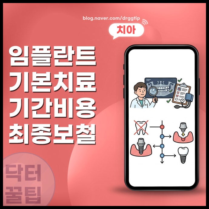 구성역 치과 임플란트 기본 치료 기간과 발치부터 임시치아 최종 보철까지 과정 총정리