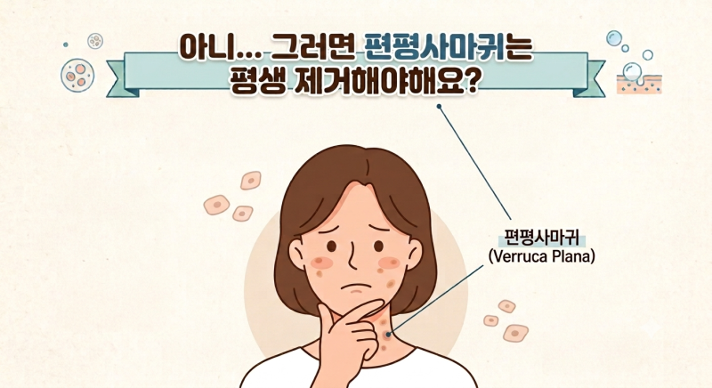 대전편평사마귀제거) 제거해도 재발되는 편평사마귀, 그 이유와 해결책은?