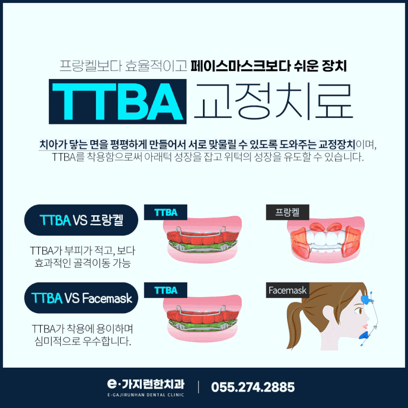 어린이 주걱턱 교정 시기, 창원교정치과에서 확인해야 할 기준