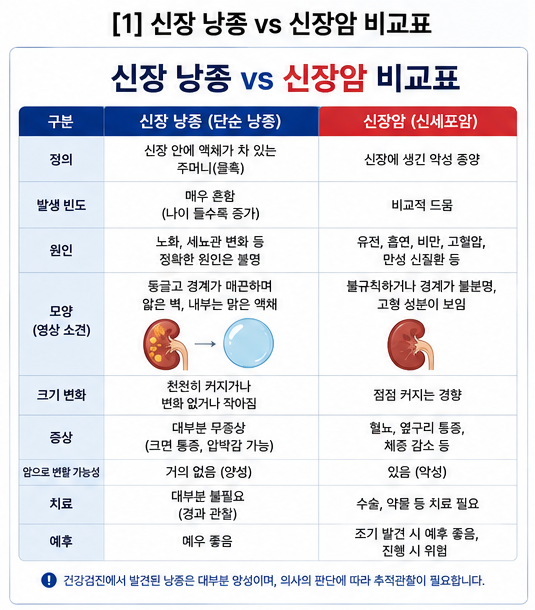 건강검진에서 '신장 낭종'이 발견됐습니다. 물혹인데 괜찮을까요? 암과 어떻게 다를까요?