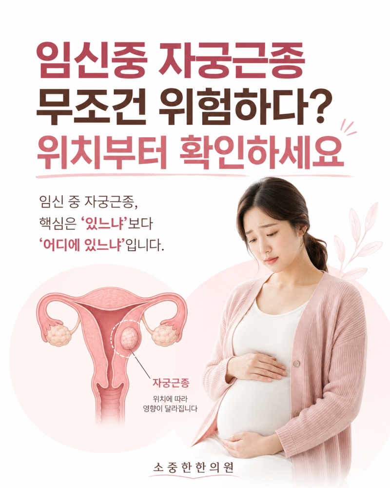 임신중 자궁근종 무조건 위험하다? 위치부터 확인하세요