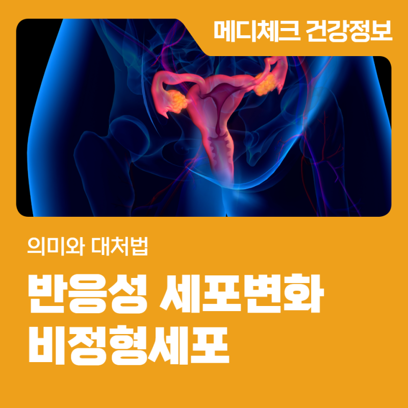 창원종합건강검진 '반응성 세포변화'와 '비정형세포' 의미와 대처법