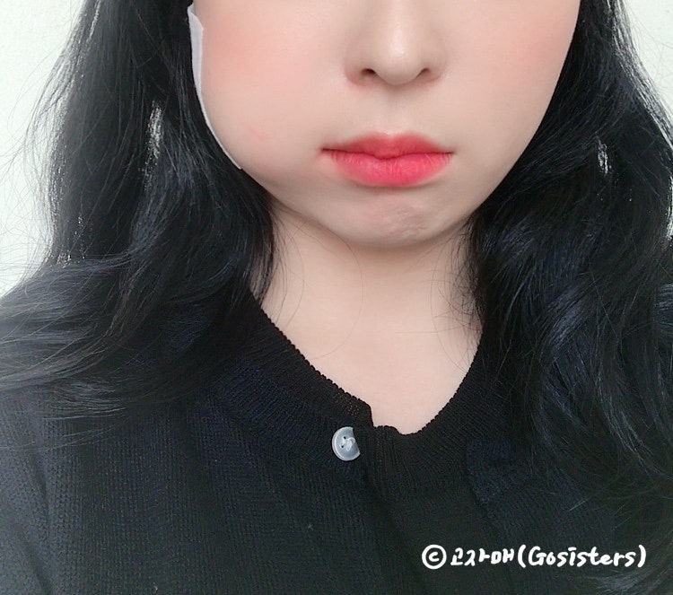 사랑니 치과로 유명한 신촌 잎사귀치과 발치 후기 / 통증 / 비용 / 식사