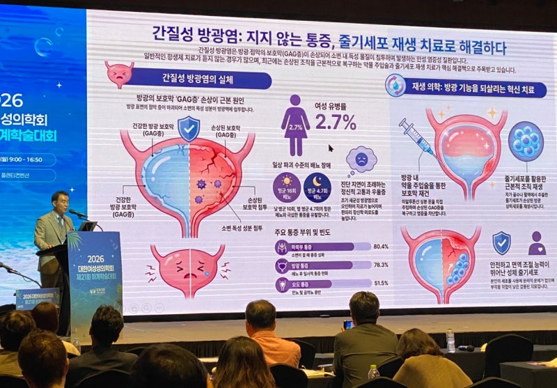 난치성 간질성 방광염, 자가 줄기세포로 새로운 가능성 제시(스마트엠셀)