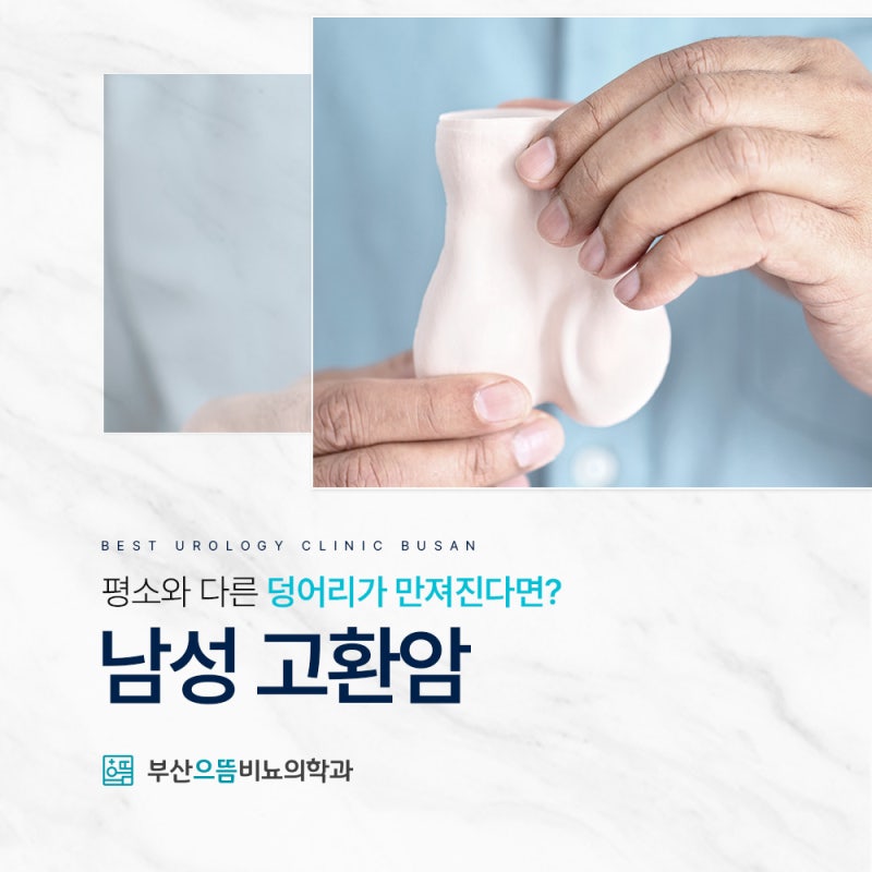 고환에혹 통증 없는 덩어리도 확인이 필요한 이유