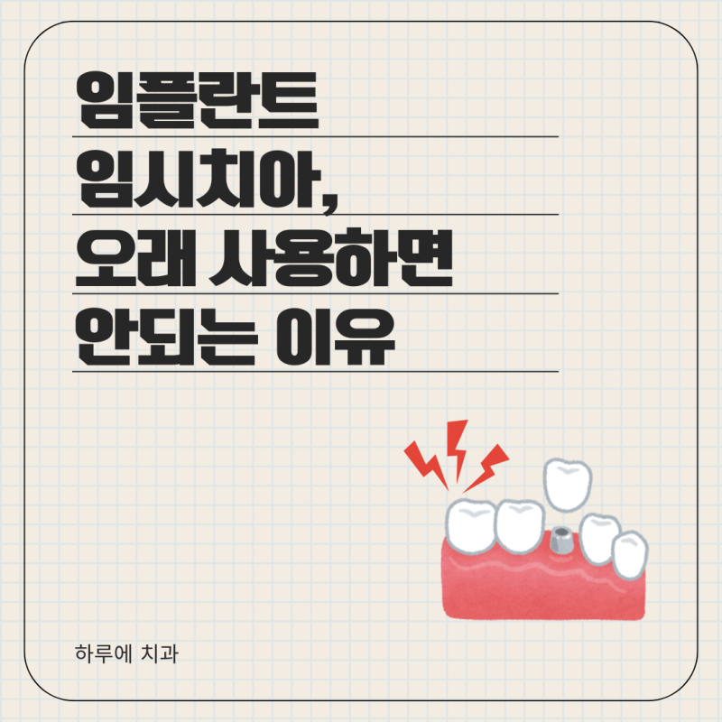 임플란트 임시치아 사용기간 총정리, 적정 교체 시기와 주의사항