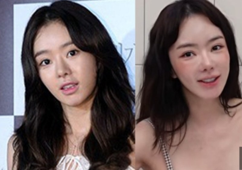 서우 K 메이크업 변신 자가면역질환 고백 후 달라진 근황