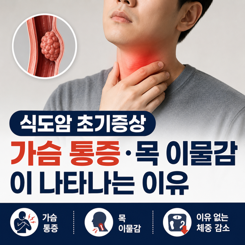 식도암 초기증상, 가슴 통증·목 이물감이 나타나는 이유
