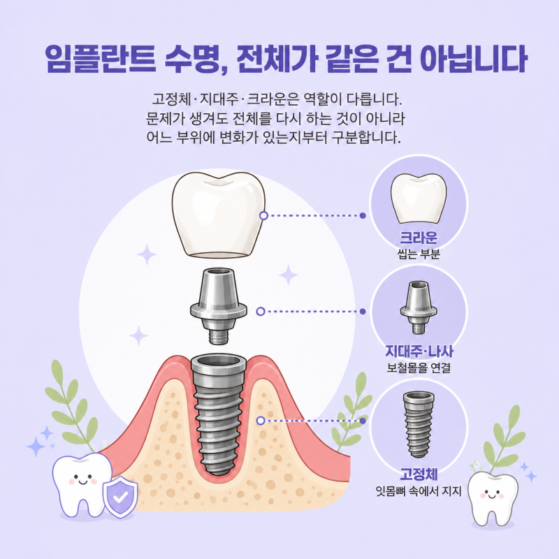 임플란트 수명 5년? 10년? 임플란트도 수명이 있을까?