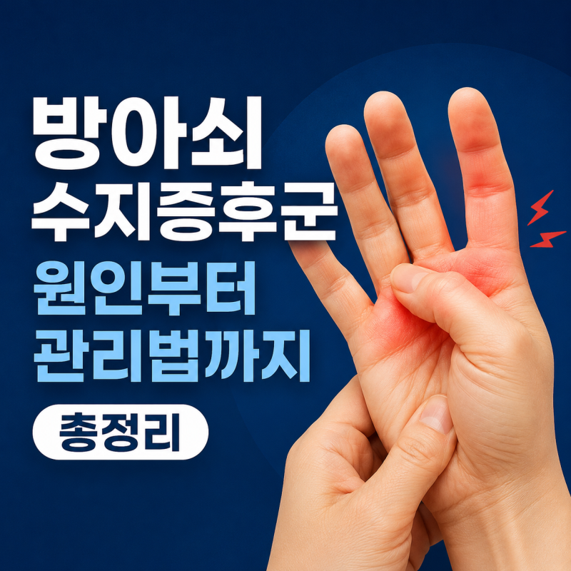 방아쇠수지증후군 원인부터 관리법까지 총정리
