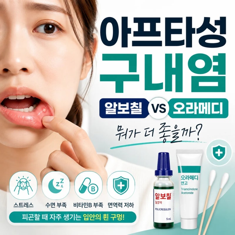 아프타성 구내염 원인｜알보칠 vs 오라메디, 뭐가 더 좋을까요?