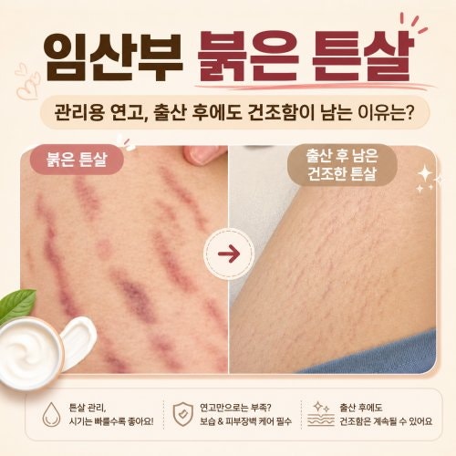임산부 붉은 튼살 관리용 연고, 출산 후에도 건조함이 남는 이유는?
