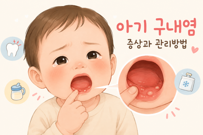 아기 구내염 후기: 39도 고열 4일, 해열 수액과 경구수액 효과