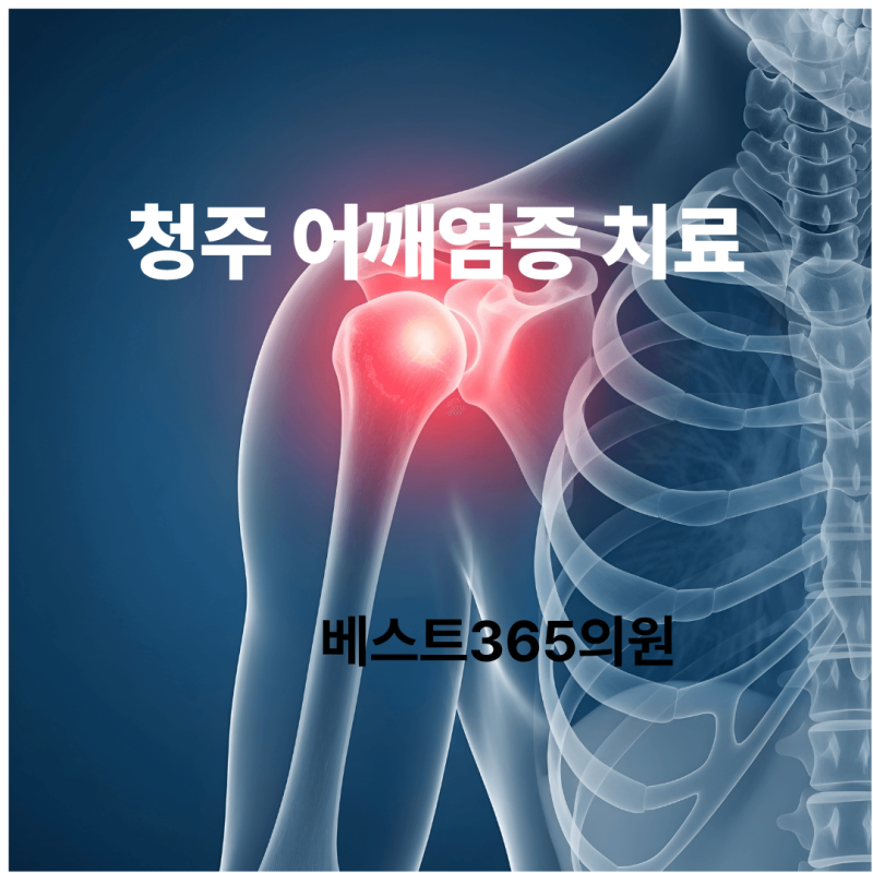 청주어깨염증치료, 어깨통증의 원인부터 회전근개파열과의 차이