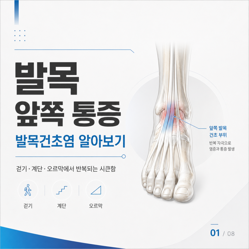 무리한 활동 후 발목 앞쪽 통증, 발목건초염 예방과 관절 이완법
