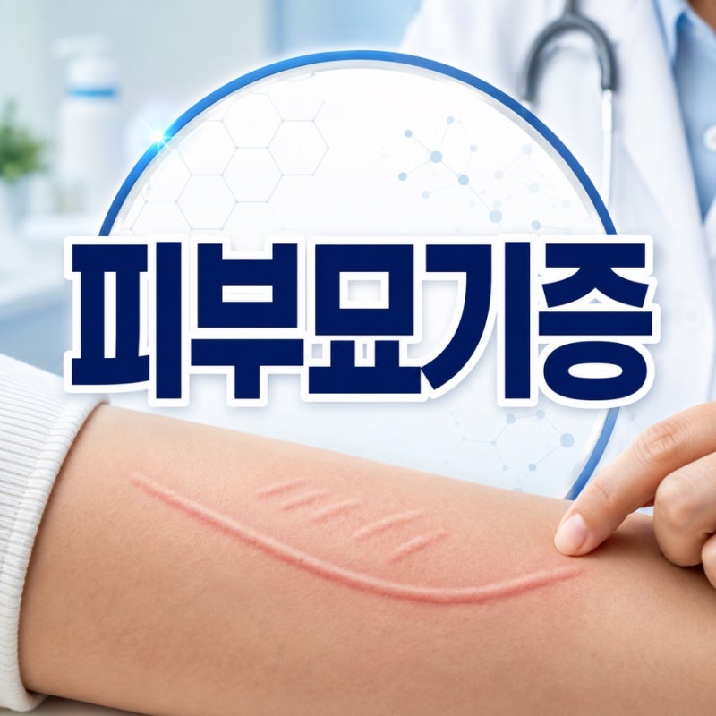 피부묘기증 원인과 증상, 긁으면 부풀어 오르는 이유와 관리법