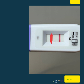 인공수정2차 시술 과정 및 인공수정 증상 비임신 종결