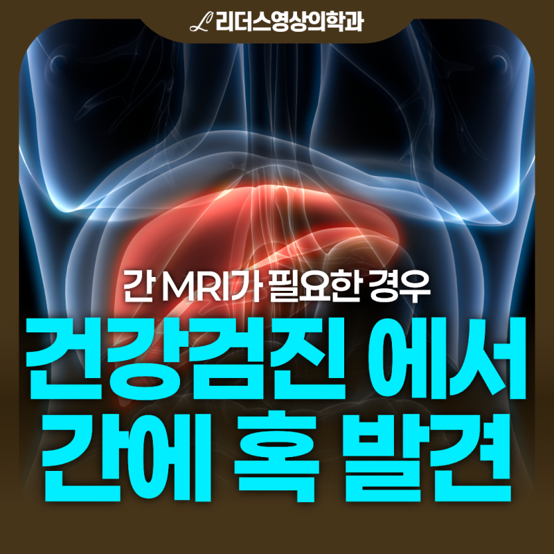 간에 혹이 발견됐다면? 건강검진 후 간 물혹·간암, MRI가 필요한 경우 | 인천 영상의학과