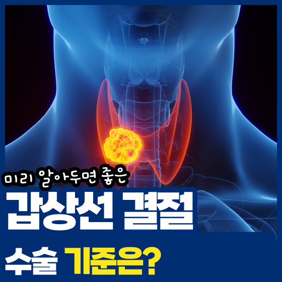 갑상선 결절 수술 기준, 크기보다 중요한 것은 따로 있습니다
