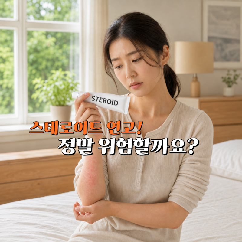 스테로이드 연고, 무조건 나쁠까? 잘못 알려진 상식 4가지