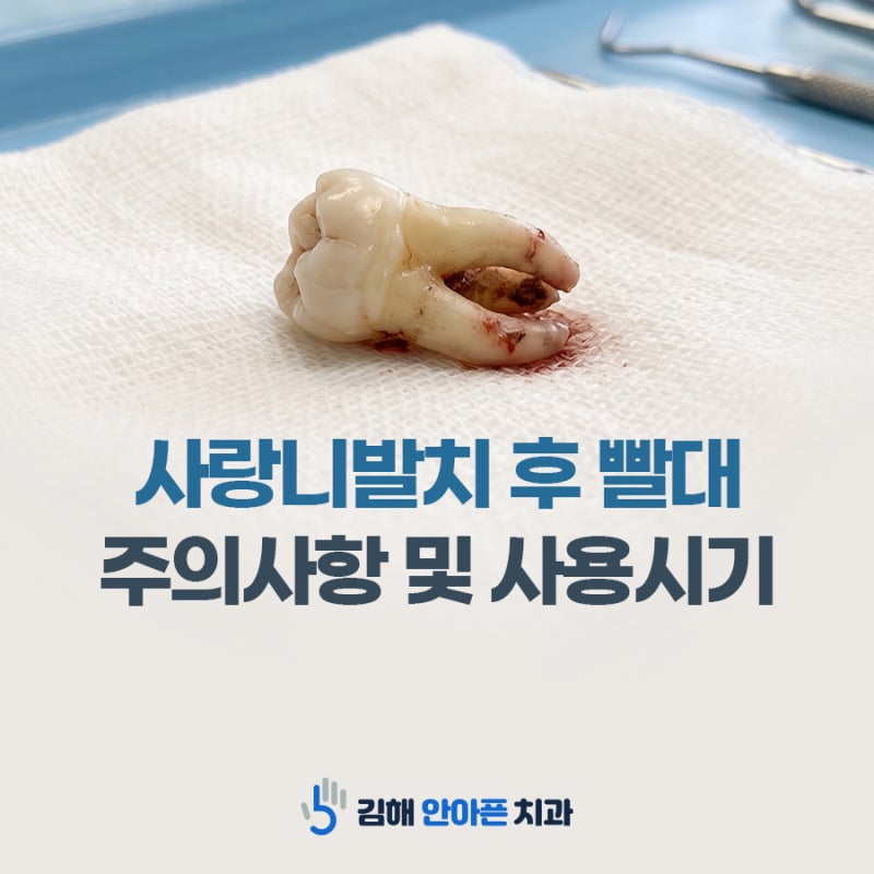 사랑니발치 후 빨대 언제까지 사용 못 하나요?