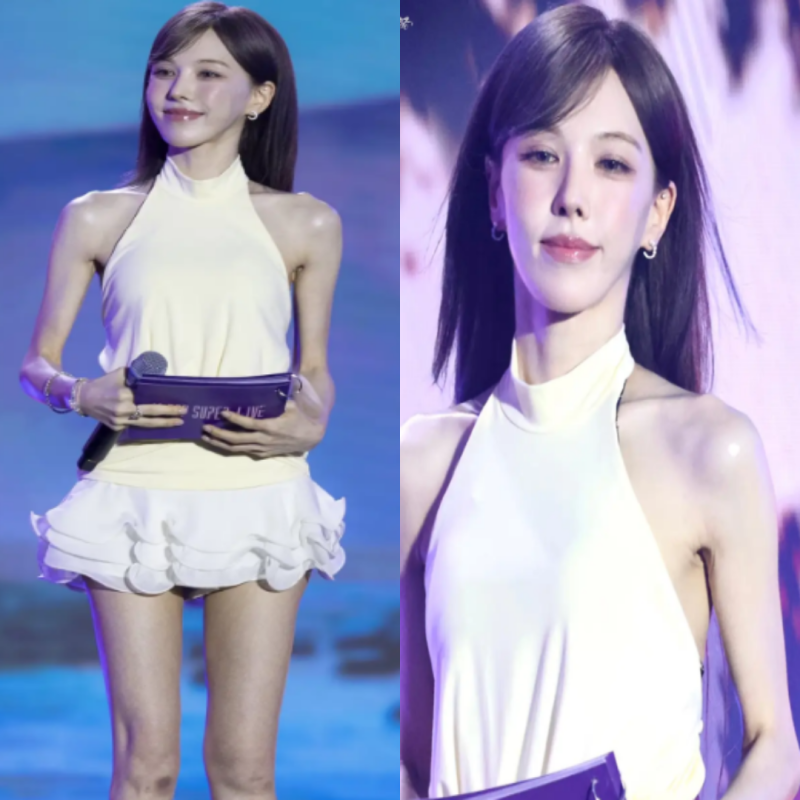 레드벨벳 웬디 뼈말라 근황, 최근 사진 보고 깜짝 놀란 이유