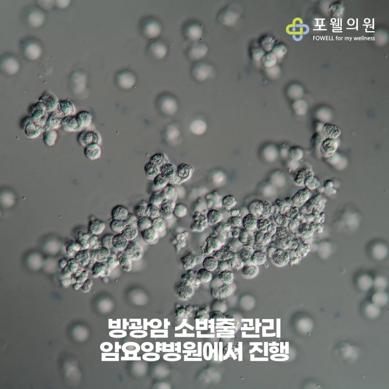 방광암 소변줄 관리 암요양병원에서 진행