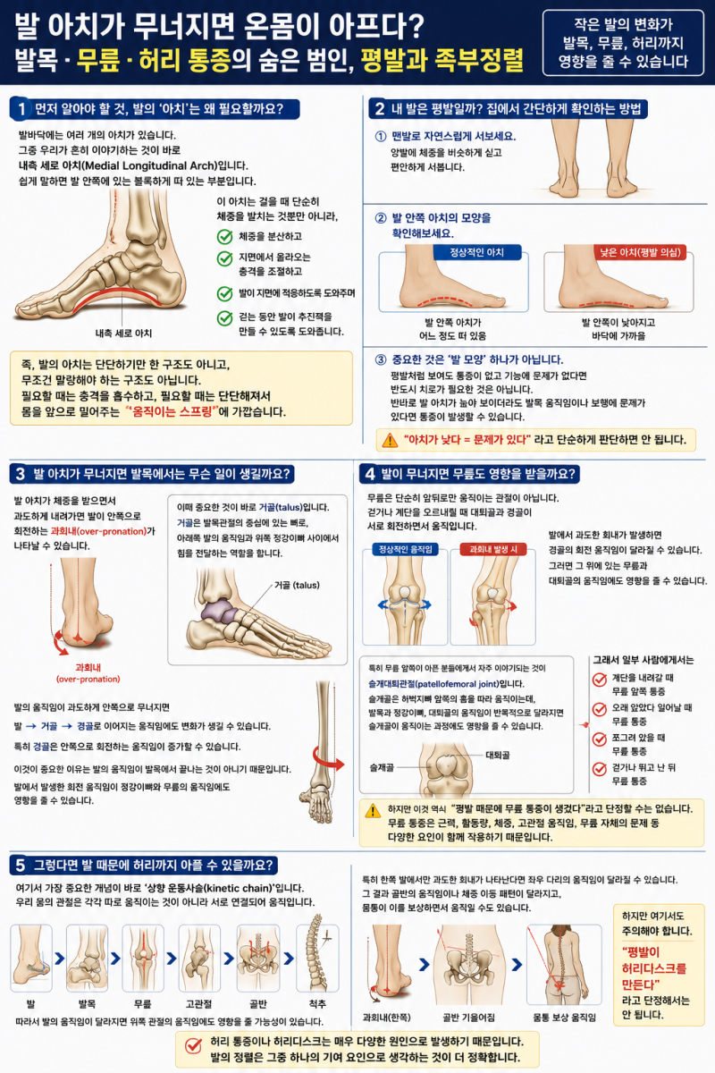 발의 아치가 무너지면 온몸이 아플까?발목·무릎·허리 통증의 숨은 원인, 평발과 족부정렬 ....