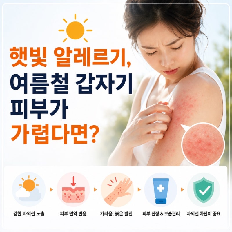 햇빛 알레르기, 여름철 갑자기 피부가 가렵다면?
