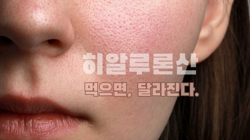 히알루론산 영양제 효능과 원액의 차이, 먹는 것과 바르는 것 중 뭘 선택할까