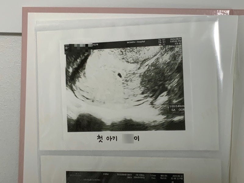 임신 9주차 태아의 심장 멈춤, 갑작스러운 계류유산