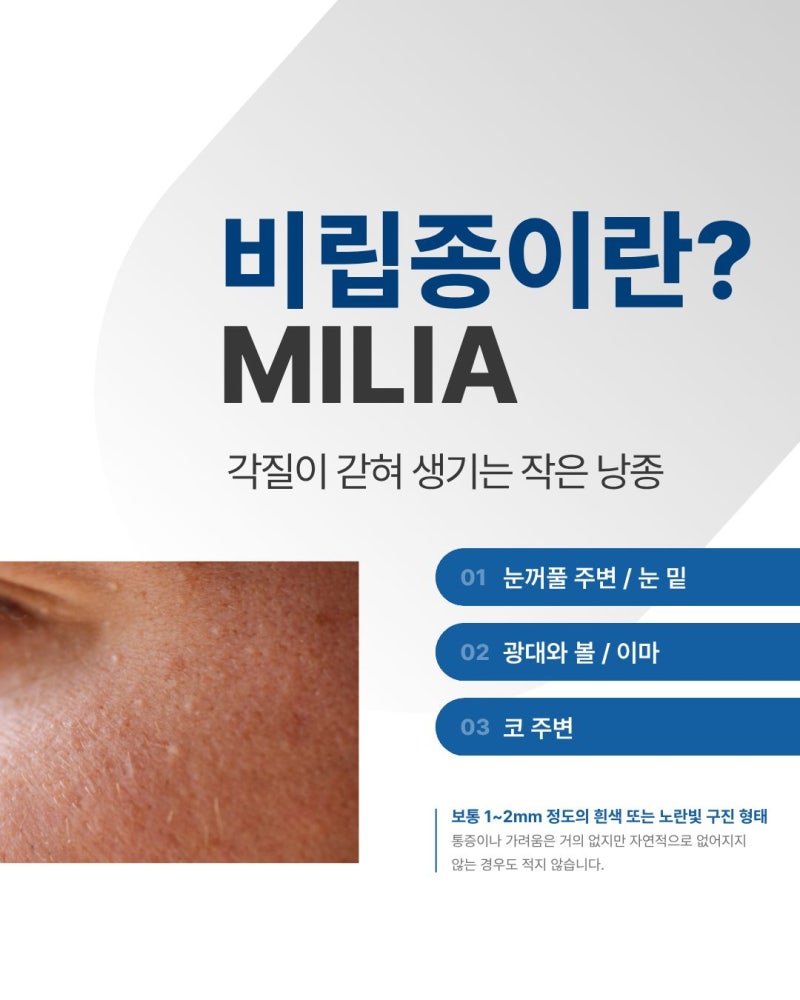 강남 비립종 피부과, 작은 돌기라고 방치하면 안 되는 이유
