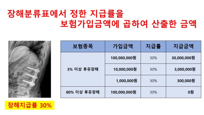 후유장해 특약 가입해야 하는 이유 후유장해 지급 보험금은 얼마일까? 후유장해 특약 가입금....