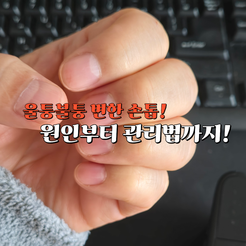 손톱 울퉁불퉁하고 갈라짐, 원인과 관리법 알아보기