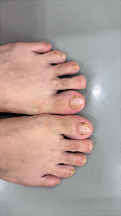 돈키호테발톱무좀 두 달 밀어보고 솔직히 놀란 후기