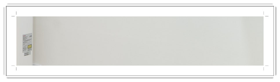 부천치과추천 임플란트 CT 촬영으로 정밀 진단부터